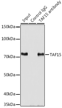 TAF15 Rabbit polyclonal antibody