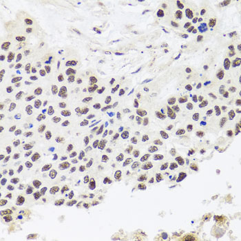 RPP30 Rabbit polyclonal antibody