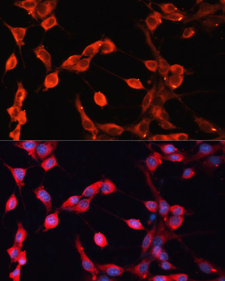 ADAMTS13 Rabbit polyclonal antibody