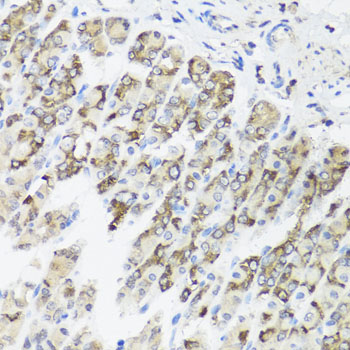 TIMM10B Rabbit polyclonal antibody