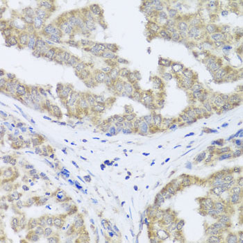 TIMM10B Rabbit polyclonal antibody
