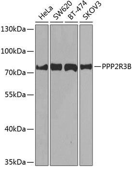 PPP2R3B Rabbit polyclonal antibody