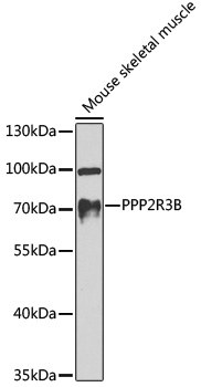 PPP2R3B Rabbit polyclonal antibody