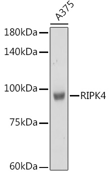 RIPK4 Rabbit polyclonal antibody