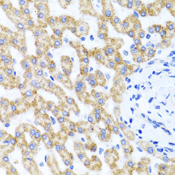 RIPK4 Rabbit polyclonal antibody
