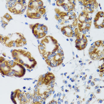 RIPK4 Rabbit polyclonal antibody