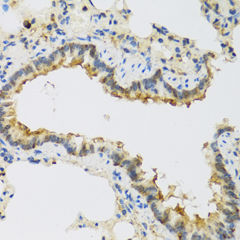 FAM20A Rabbit polyclonal antibody