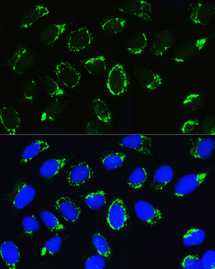 PTCD3 Rabbit polyclonal antibody