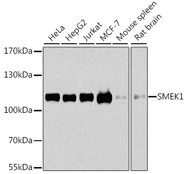 SMEK1 Rabbit polyclonal antibody