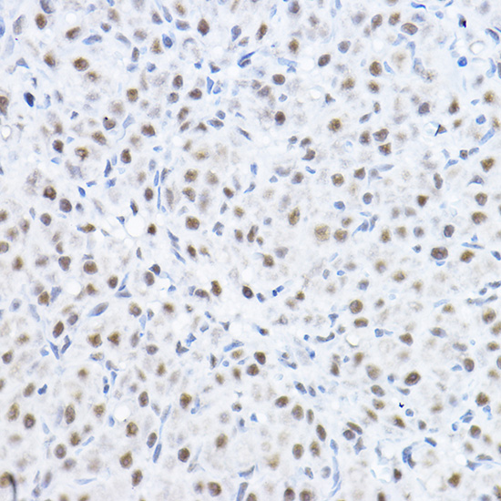 SMEK1 Rabbit polyclonal antibody