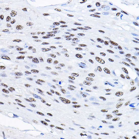 SMEK1 Rabbit polyclonal antibody