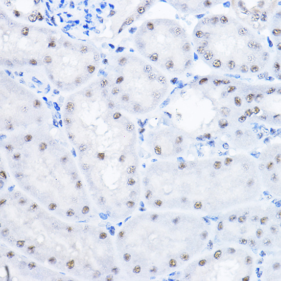SMEK1 Rabbit polyclonal antibody
