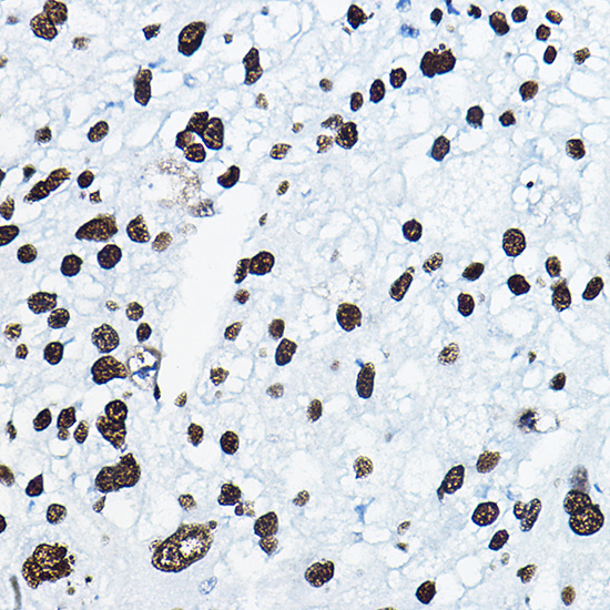 MKL1 Rabbit polyclonal antibody