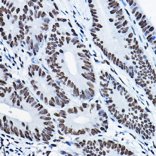 MKL1 Rabbit polyclonal antibody