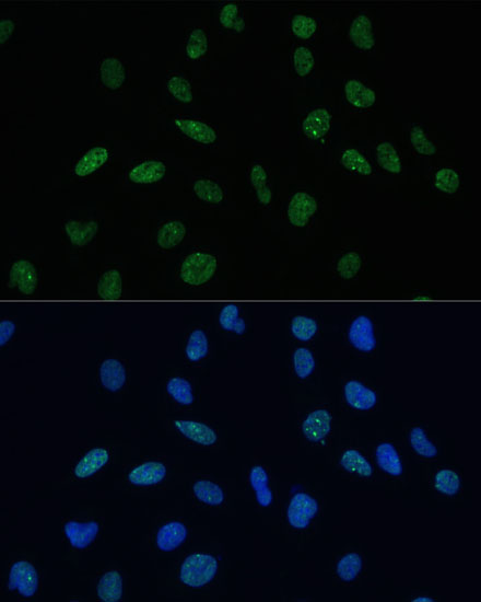 MKL1 Rabbit polyclonal antibody