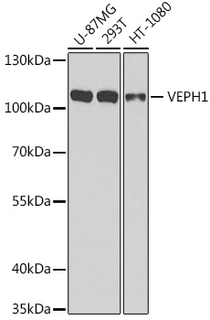 VEPH1 Rabbit polyclonal antibody