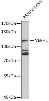 VEPH1 Rabbit polyclonal antibody