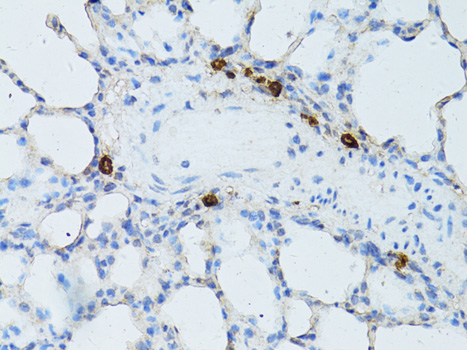 TEFM Rabbit polyclonal antibody