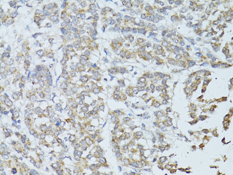 TEFM Rabbit polyclonal antibody