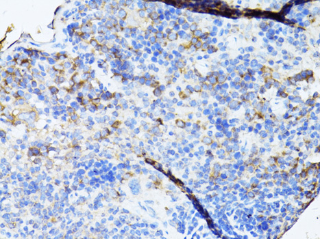 TEFM Rabbit polyclonal antibody