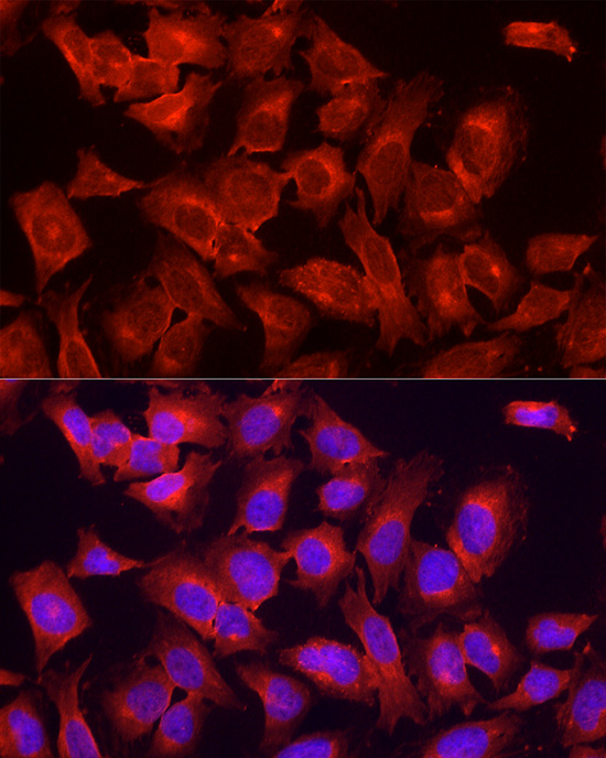 ULK1 Rabbit polyclonal antibody