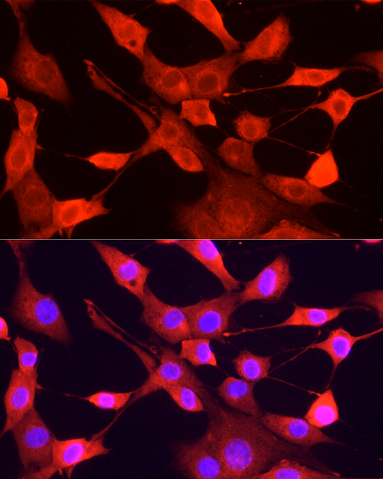 ULK1 Rabbit polyclonal antibody