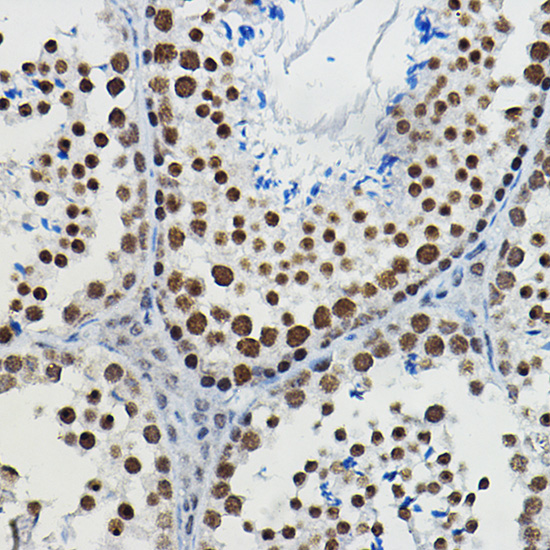 METTL14 Rabbit polyclonal antibody