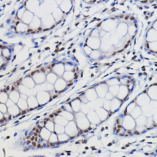 METTL14 Rabbit polyclonal antibody