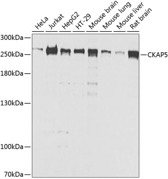 CKAP5 Rabbit polyclonal antibody