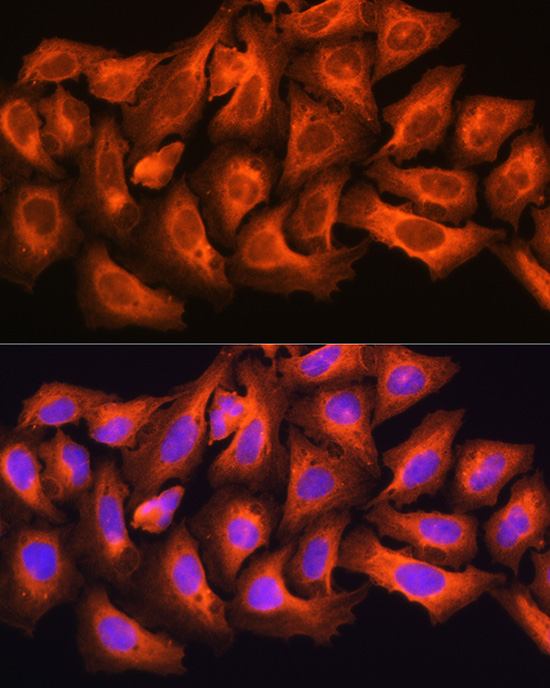CKAP5 Rabbit polyclonal antibody