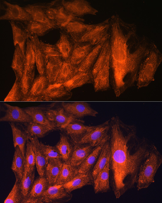 CKAP5 Rabbit polyclonal antibody