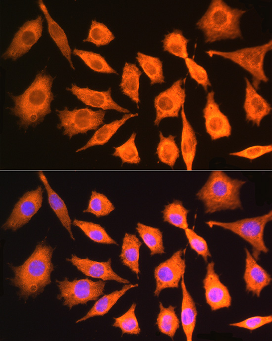 CKAP5 Rabbit polyclonal antibody