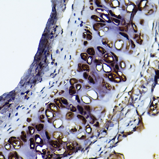 Aggrecan Rabbit polyclonal antibody