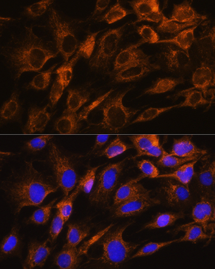 AQP8 Rabbit polyclonal antibody