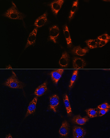 AQP8 Rabbit polyclonal antibody
