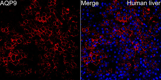 AQP9 Rabbit polyclonal antibody