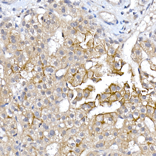 AQP9 Rabbit polyclonal antibody