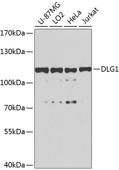 DLG1 Rabbit polyclonal antibody