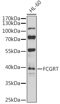 FCGRT Rabbit polyclonal antibody