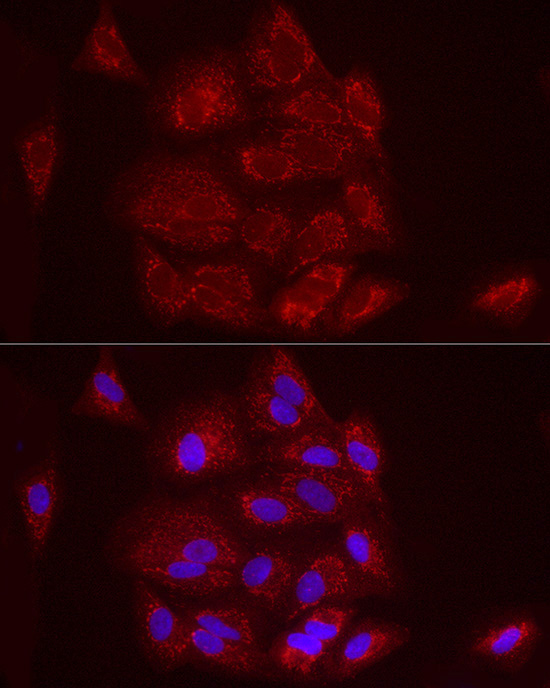 FCGRT Rabbit polyclonal antibody