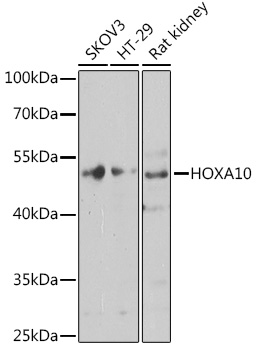 HOXA10 Rabbit polyclonal antibody