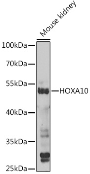 HOXA10 Rabbit polyclonal antibody