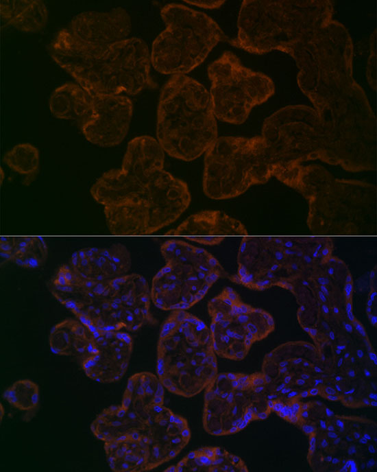 MYO5B Rabbit polyclonal antibody