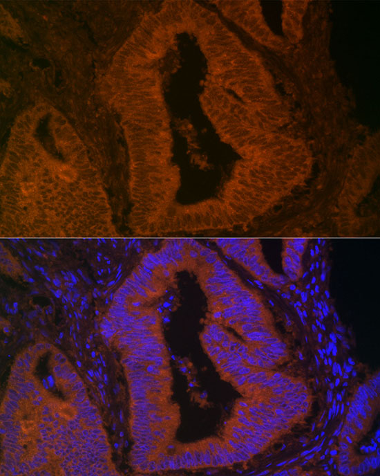 MYO5B Rabbit polyclonal antibody