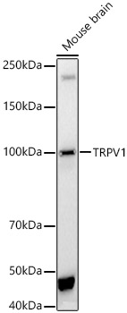 TRPV1 Rabbit polyclonal antibody