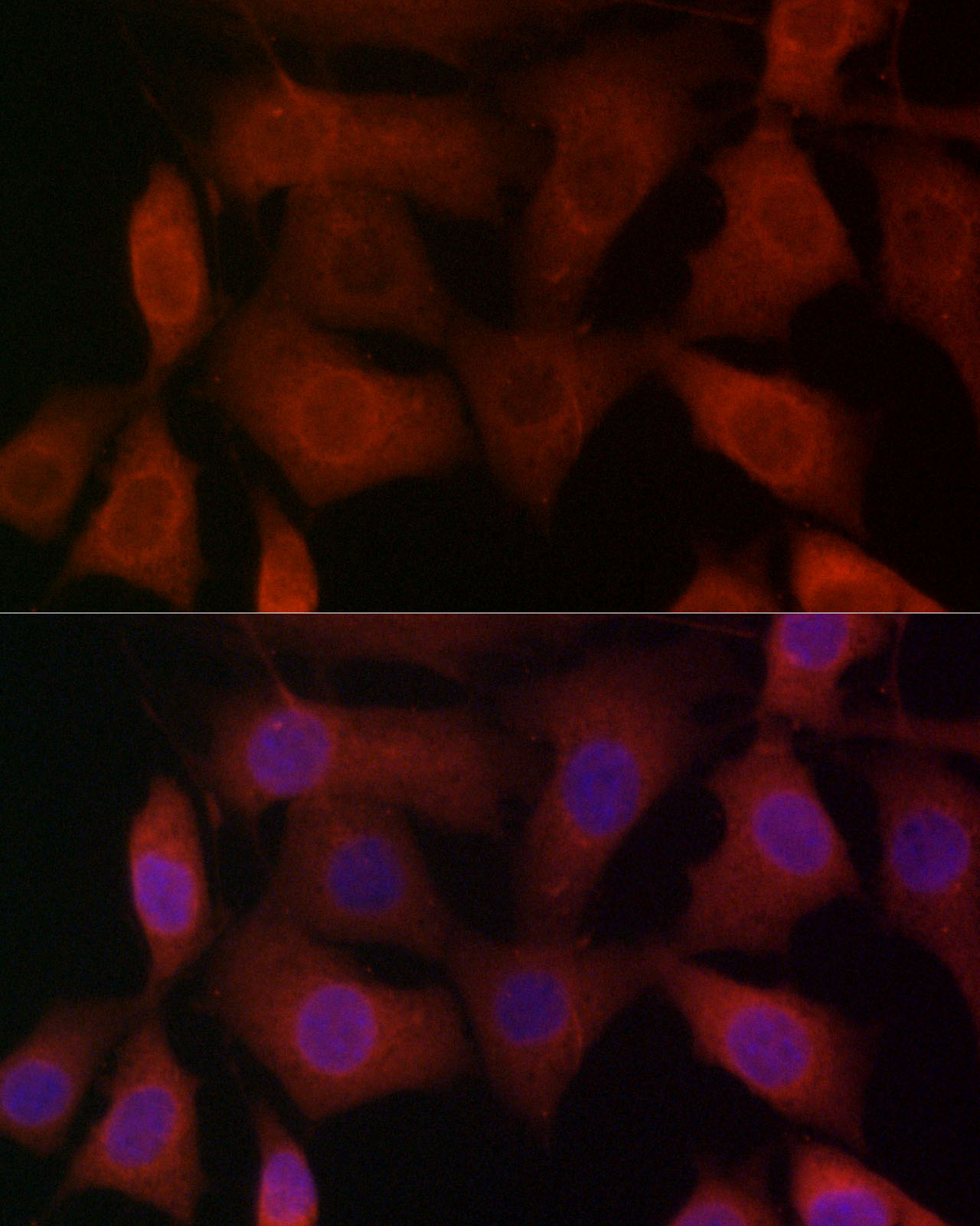 TRPV1 Rabbit polyclonal antibody
