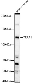 TRPA1 Rabbit polyclonal antibody