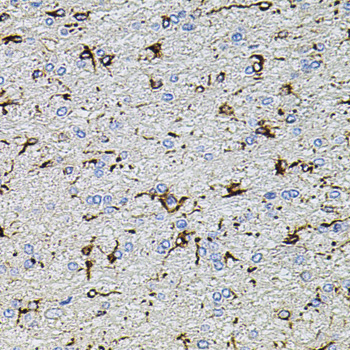 TRPA1 Rabbit polyclonal antibody