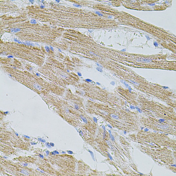 TRPA1 Rabbit polyclonal antibody