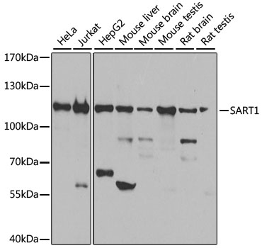 SART1 Rabbit polyclonal antibody